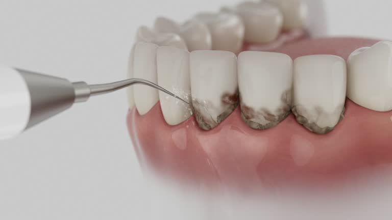 Reliable Teeth Cleaning And Checkup contractor in Anoka County County, MN by Dentist Open Now